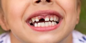 Toothing Tooth – Semnificația Și Simbolismul Viselor 23