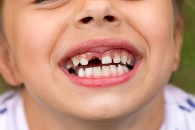Toothing Tooth – Semnificația Și Simbolismul Viselor 1